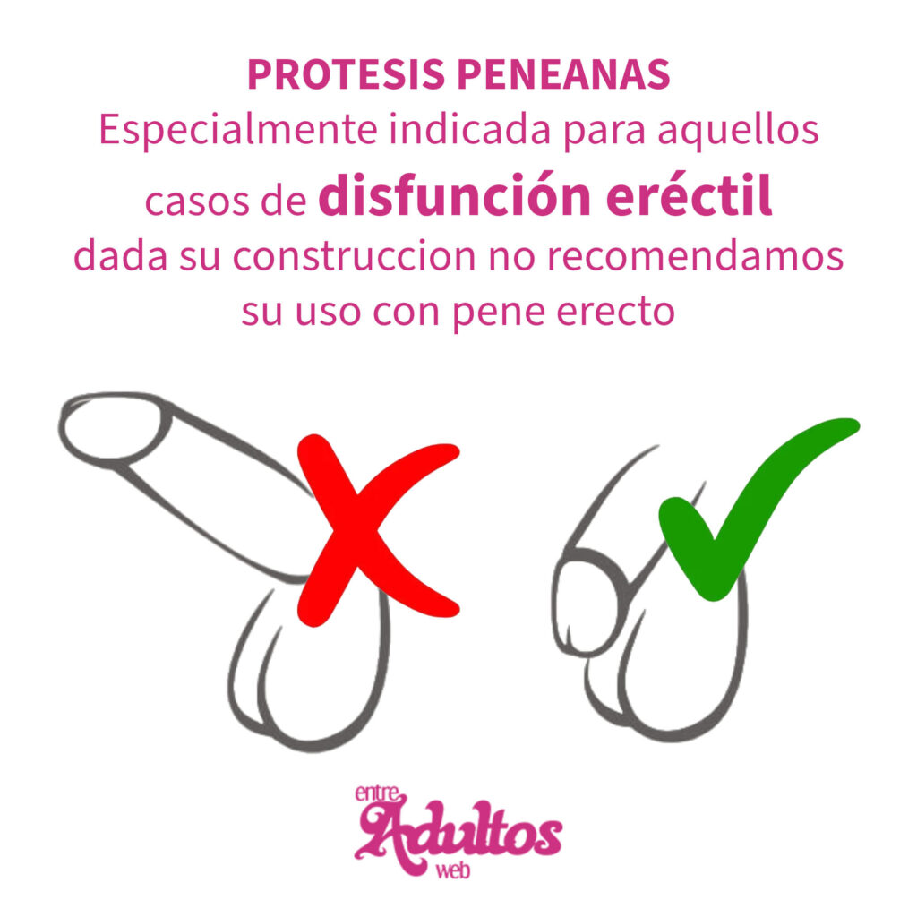 Protesis Peneana Semirigida Pellizcable Mod 4 (15×4cm)